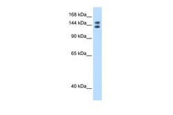 Aviva Systems Biology Corp Mybbp1a Antibody - C-terminal region (ARP37905_P050)
