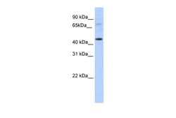Aviva Systems Biology Corp LMX1A Antibody - C-terminal region (ARP37928_T100)