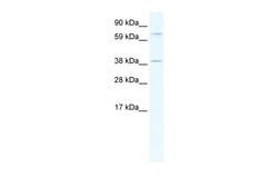 Aviva Systems Biology Corp MKX Antibody - middle region (ARP37938_T100)