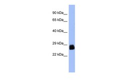 Aviva Systems Biology Corp PDX1 Antibody - N-terminal region (ARP37972_P050)