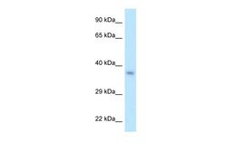 Aviva Systems Biology Corp PITX2 Antibody - N-terminal region (ARP37981_P050)