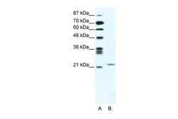 Aviva Systems Biology Corp TWIST1 Antibody - C-terminal region (ARP37997_T100)