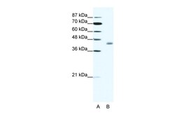 Aviva Systems Biology Corp LDB2 Antibody - C-terminal region (ARP38021_T100)