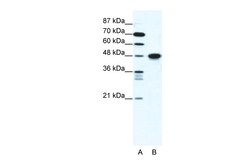 Aviva Systems Biology Corp ENO1 Antibody - C-terminal region (ARP38031_T100)