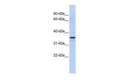 Aviva Systems Biology Corp TADA2L Antibody - N-terminal region (ARP38044_P050)
