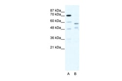 Aviva Systems Biology Corp TRIM23 Antibody - C-terminal region (ARP38065_T100)