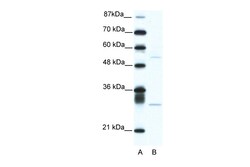 Aviva Systems Biology Corp ATF4 Antibody - C-terminal region (ARP38067_T100)