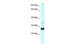 Aviva Systems Biology Corp Cdx1 Antibody - C-terminal region (ARP38076_P050)