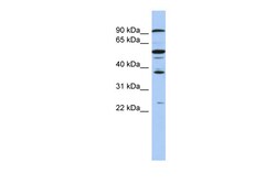 Aviva Systems Biology Corp EZH1 Antibody - N-terminal region (ARP38092_P050)