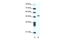 Aviva Systems Biology Corp FLI1 Antibody - N-terminal region (ARP38096_T100)