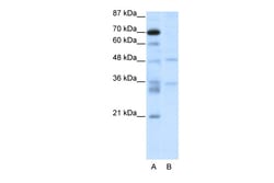 Aviva Systems Biology Corp HTLF Antibody - C-terminal region (ARP38121_T100)