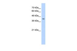 Aviva Systems Biology Corp IRF1 Antibody - N-terminal region (ARP38128_P050)