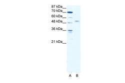 Aviva Systems Biology Corp IRF5 Antibody - N-terminal region (ARP38131_T100)