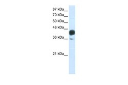 Aviva Systems Biology Corp JUNB Antibody - C-terminal region (ARP38136_P050)