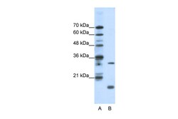 Aviva Systems Biology Corp MAX Antibody - middle region (ARP38145_T100)