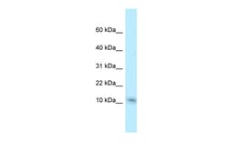Aviva Systems Biology Corp Nme1 Antibody - C-terminal region (ARP38169_P050)