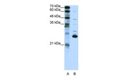 Aviva Systems Biology Corp RCV1 Antibody - C-terminal region (ARP38196_P050)