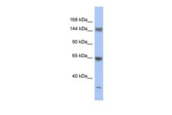 Aviva Systems Biology Corp ATXN2 Antibody - middle region (ARP38210_P050)