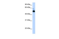 Aviva Systems Biology Corp TRIM21 Antibody - C-terminal region (ARP38248_T100)