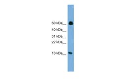 Aviva Systems Biology Corp SUPT4H1 Antibody - middle region (ARP38258_P050)