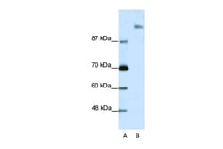 Aviva Systems Biology Corp SUPT6H Antibody - N-terminal region (ARP38260_T100)