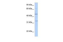 Aviva Systems Biology Corp TFAP2B Antibody - C-terminal region (ARP38283_P050)