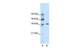 Aviva Systems Biology Corp ZNF124 Antibody - N-terminal region (ARP38327_T100)
