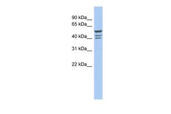 Aviva Systems Biology Corp ZNF140 Antibody - middle region (ARP38336_P050)