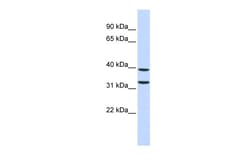 Aviva Systems Biology Corp ZNF177 Antibody - middle region (ARP38347_P050)