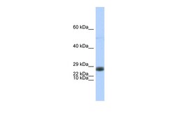Aviva Systems Biology Corp EDF1 Antibody - middle region (ARP38383_P050)
