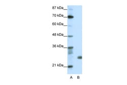 Aviva Systems Biology Corp SAP30 Antibody - N-terminal region (ARP38392_T100)