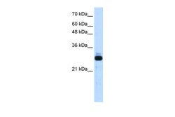 Aviva Systems Biology Corp SAP30 Antibody - middle region (ARP38393_T100)