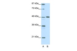 Aviva Systems Biology Corp ZPR1 Antibody - C-terminal region (ARP38400_P050)