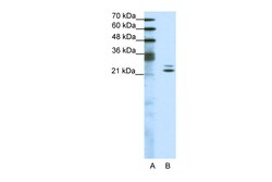 Aviva Systems Biology Corp BUD31 Antibody - middle region (ARP38402_T100)