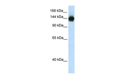 Aviva Systems Biology Corp TIMELESS Antibody - N-terminal region (ARP38403_T100)
