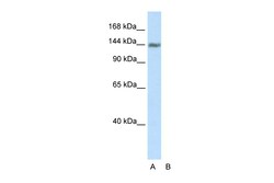 Aviva Systems Biology Corp TIMELESS Antibody - C-terminal region (ARP38404_T100)