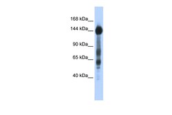 Aviva Systems Biology Corp SREBF1 Antibody - N-terminal region (ARP38419_P050)