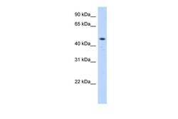 Aviva Systems Biology Corp ZNF213 Antibody - middle region (ARP38426_P050)