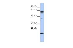 Aviva Systems Biology Corp TRIP10 Antibody - middle region (ARP38438_P050)