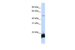 Aviva Systems Biology Corp ONECUT1 Antibody - N-terminal region (ARP38480_P050)