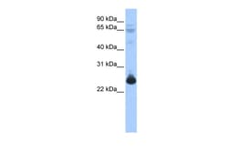 Aviva Systems Biology Corp TCEAL1 Antibody - middle region (ARP38513_P050)