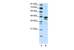 Aviva Systems Biology Corp WDR39 Antibody - C-terminal region (ARP38517_P050)