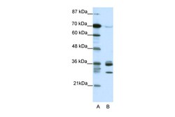 Aviva Systems Biology Corp CDK5 Antibody - C-terminal region (ARP38526_T100)