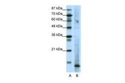 Aviva Systems Biology Corp MDS1 Antibody - N-terminal region (ARP38536_T100)