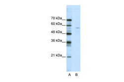 Aviva Systems Biology Corp ELK1 Antibody - N-terminal region (ARP38589_T100)