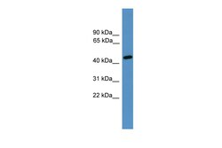 Aviva Systems Biology Corp Elk3 Antibody - N-terminal region (ARP38590_P050)