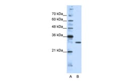 Aviva Systems Biology Corp GSCL Antibody - C-terminal region (ARP38599_T100)