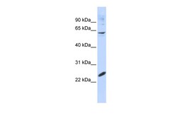 Aviva Systems Biology Corp SMAD4 Antibody - N-terminal region (ARP38605_P050)