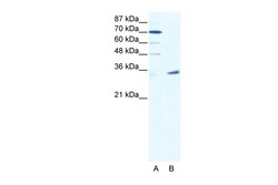 Aviva Systems Biology Corp MAGEA9 Antibody - N-terminal region (ARP38610_T100)