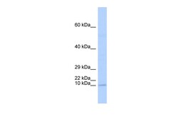 Aviva Systems Biology Corp TAL2 Antibody - N-terminal region (ARP38618_P050)
